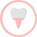 სტომატოლოგიური იმპლანტი - dental implant