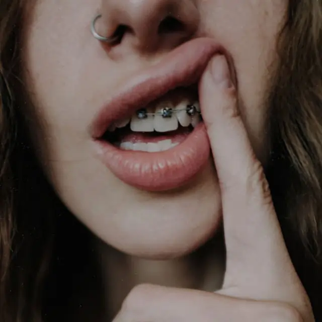ორთოდონტია
