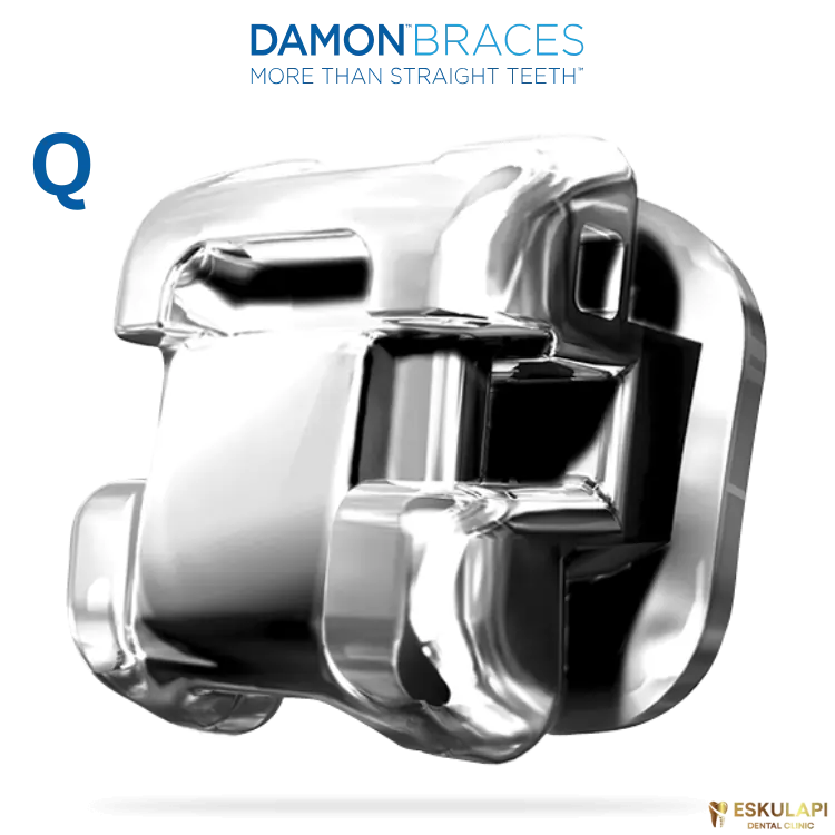 DAMON Q მეტალის თვითლიგირებადი ბრეკეტები