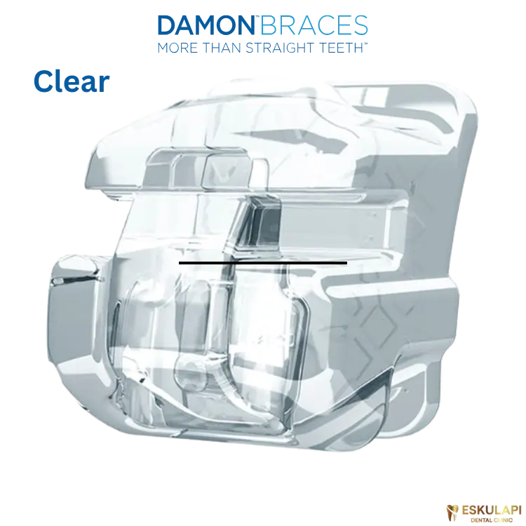 გამჭვირვალე ბრეკეტები Damon Clear