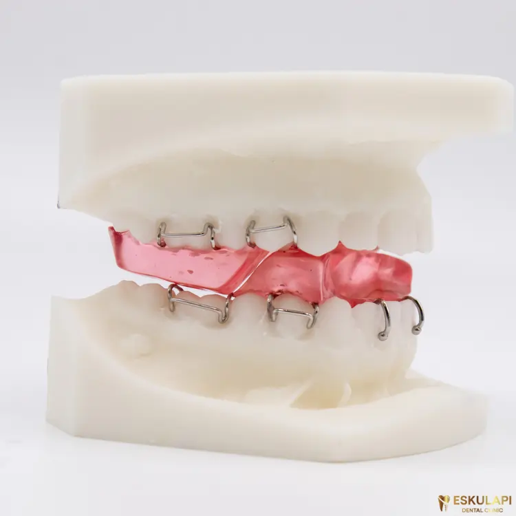 dental Functional device Twin Block